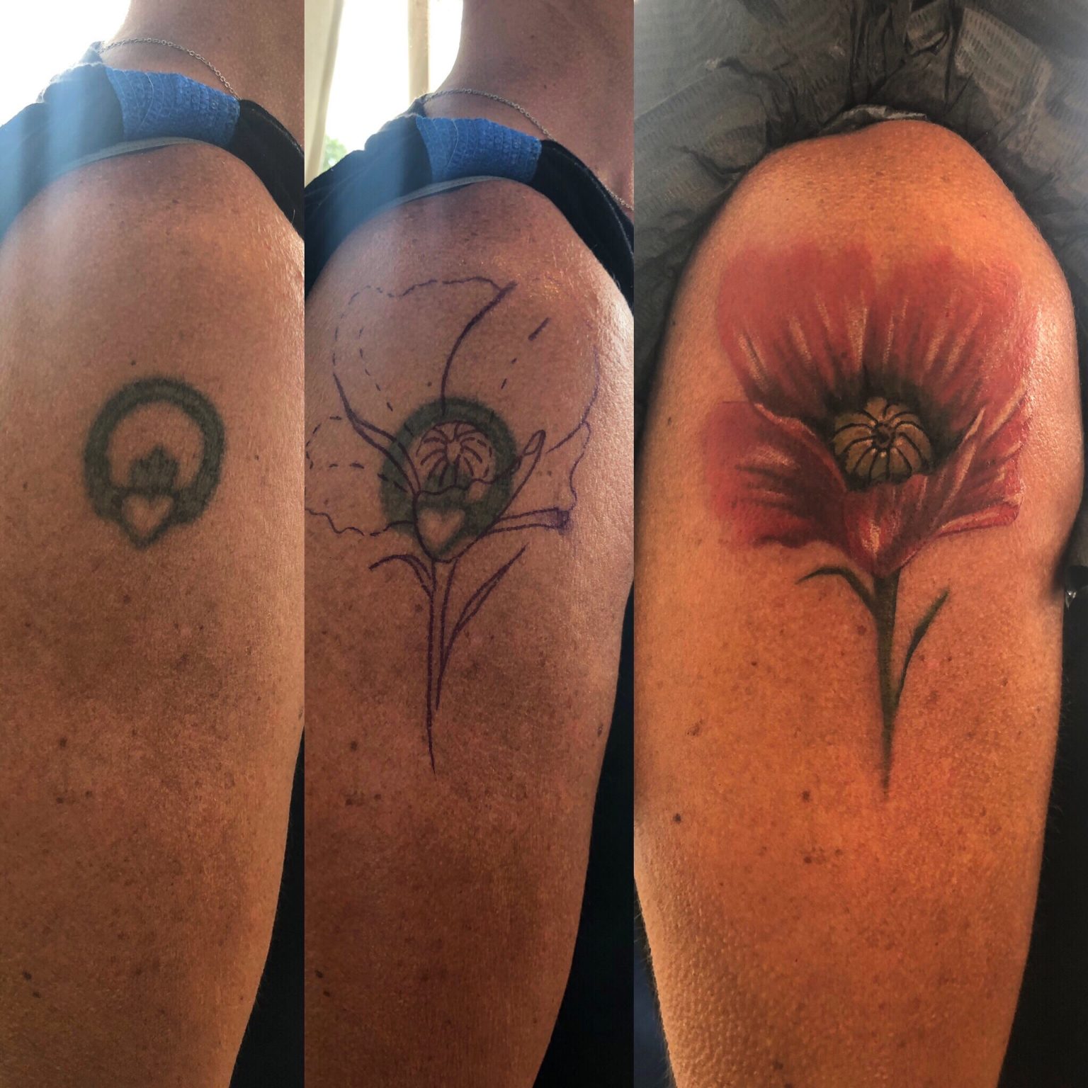 Poppy Cover Up Shoulder Tattoo